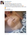 Пост Ольги Жемчуговой ВКонтакте о пластике груди